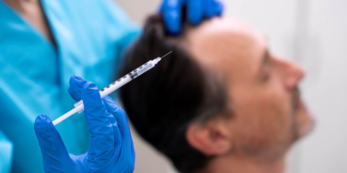 Profesional de la medicina estética sostiene la parte superior de la cabeza de un hombre mientras aplica con una inyección terapia con exosomas